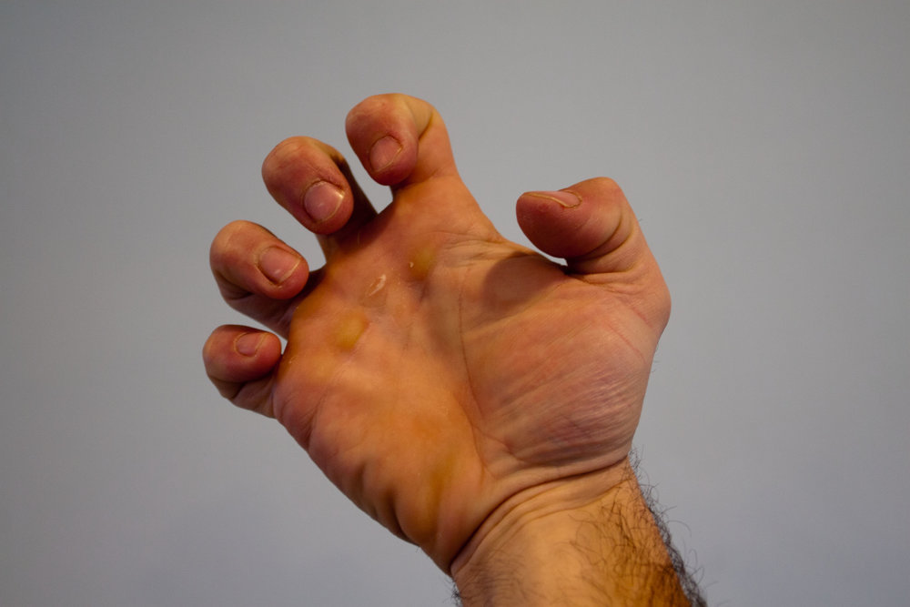 Hand rehab after stroke can be a challenging process, but your chances of regaining your hand movements increase every time you involve your hand in an activity.